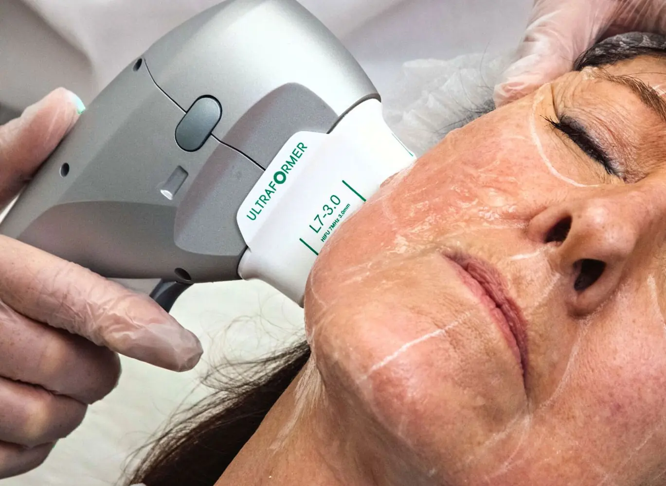 "This HIFU machine fits perfectly into our aesthetic treatment lineup. It offers impressive results for both face and body contouring, and the treatment sessions are short with no downtime. I highly recommend it for any beauty clinic looking to expand their services."